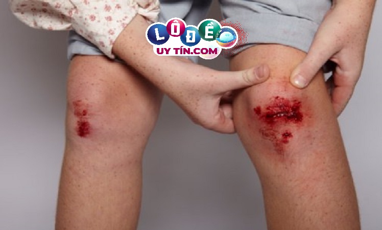 Mơ thấy máu là điềm gì, đánh con gì? 19 Mơ thấy máu là điềm gì, đánh con gì?